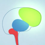 CD Brain State Model